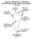 Fig. 02 - Mesenchymal Stem Cell Isolation And Transplantation Method And System To Be Used In A Clinical Setting