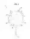 Fig. 04 - Chondrocyte therapeutic delivery system
