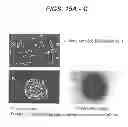 Fig. 16 - Chondrocyte therapeutic delivery system