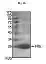 Fig. 03 - Amyloid-beta clearance