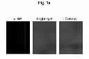 Fig. 08 - Amyloid-beta clearance