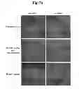 Fig. 19 - Amyloid-beta clearance