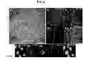 Fig. 07 - DOPAMINERGIC NEURONS DIFFERENTIATED FROM PLURIPOTENT STEM CELLS AND USES OF THEREOF
