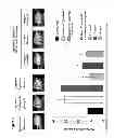 Fig. 04 - Delivery of H2 Antagonists