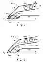 Fig. 05 - Method and apparatus for thermal treatment of printing surface in relief printing