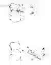Fig. 04 - Reshapable Device for Fixation at a Dental Site