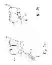 Fig. 05 - Reshapable Device for Fixation at a Dental Site