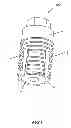 Fig. 02 - Expandable dental implants of high surface area and methods of expanding the same
