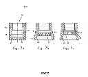 Fig. 09 - Expandable dental implants of high surface area and methods of expanding the same