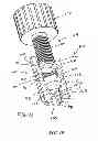 Fig. 22 - Expandable dental implants of high surface area and methods of expanding the same