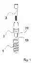Fig. 02 - Dental implant
