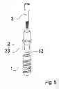 Fig. 06 - Dental implant