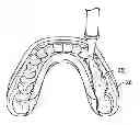 Fig. 01 - Cosmetic dental process