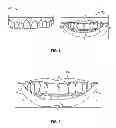 Fig. 05 - Cosmetic dental process