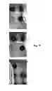 Fig. 30 - In vitro point-of-care sensor and method of use