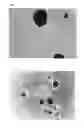Fig. 02 - Method for obtaining pancreatic endocrine cells from adipose tissue-origin cells