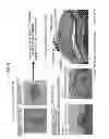 Fig. 04 - Method of producing tooth, set of teeth, and method of producing tissue
