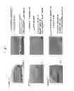 Fig. 12 - Method of producing tooth, set of teeth, and method of producing tissue