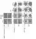 Fig. 14 - Method of producing tooth, set of teeth, and method of producing tissue