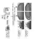 Fig. 15 - Method of producing tooth, set of teeth, and method of producing tissue