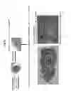 Fig. 17 - Method of producing tooth, set of teeth, and method of producing tissue