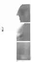 Fig. 20 - Method of producing tooth, set of teeth, and method of producing tissue