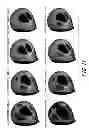 Fig. 12 - Golf club head