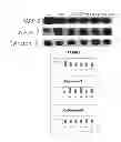 Fig. 08 - Composition for treating or preventing neurodegenerative brain diseases comprising black bean extract