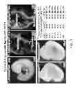 Fig. 02 - Control of Cardiac Growth, Differentiation and Hypertrophy