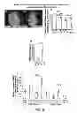 Fig. 09 - Control of Cardiac Growth, Differentiation and Hypertrophy