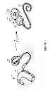 Fig. 03 - Sound awareness hearing prosthesis