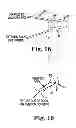 Fig. 09 - Systems, implants, tools, and methods for treatments of pelvic conditions