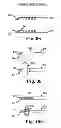 Fig. 85 - Systems, implants, tools, and methods for treatments of pelvic conditions
