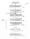 Fig. 07 - Marking system for computer-aided detection of breast abnormalities