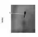 Fig. 03 - System for detecting rotation angle of a catheter in an X-ray image