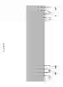Fig. 05 - System for detecting rotation angle of a catheter in an X-ray image
