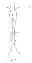 Fig. 02 - Aortic valve positioning systems, devices, and methods