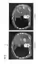 Fig. 06 - METHODS AND APPARATUS FOR ANALYZING MEDICAL IMAGING DATA