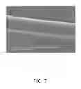 Fig. 08 - ELECTRODE LEAD OF PACEMAKER AND PACEMAKER