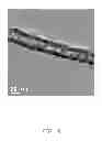 Fig. 10 - ELECTRODE LEAD OF PACEMAKER AND PACEMAKER