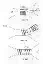 Fig. 08 - METHOD AND DEVICE FOR TREATMENT OF ARRHYTHMIAS AND OTHER MALADIES