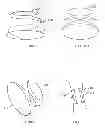 Fig. 28 - METHOD AND DEVICE FOR TREATMENT OF ARRHYTHMIAS AND OTHER MALADIES
