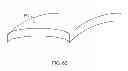 Fig. 50 - METHOD AND DEVICE FOR TREATMENT OF ARRHYTHMIAS AND OTHER MALADIES