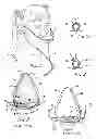 Fig. 02 - Nasal mask