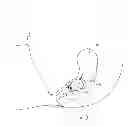 Fig. 02 - Device and method for menstrual blood collection