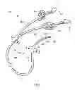 Fig. 02 - Anti-thrombogenic catheter and method