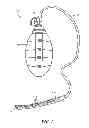 Fig. 02 - System and Method for Clearing Medical Tubing