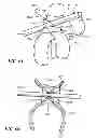 Fig. 08 - System and Method for Clearing Medical Tubing