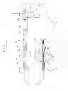 Fig. 02 - Cryogenic balloon device with radiofrequency tip