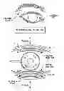 Fig. 01 - METHODS FOR TREATING EYE CONDITIONS